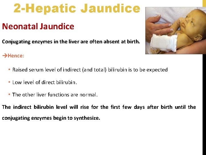 2 -Hepatic Jaundice Neonatal Jaundice Conjugating enzymes in the liver are often absent at