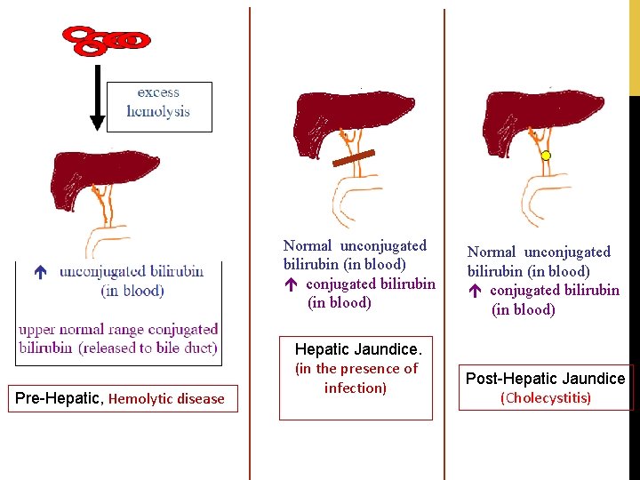 Normal unconjugated bilirubin (in blood) Pre-Hepatic, Hemolytic disease Hepatic Jaundice. (in the presence of