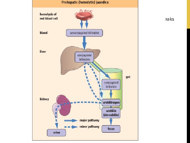 Bilirubin is a yellow compound that occurs in the normal catabolic pathway that breaks