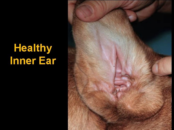 Healthy Inner Ear 