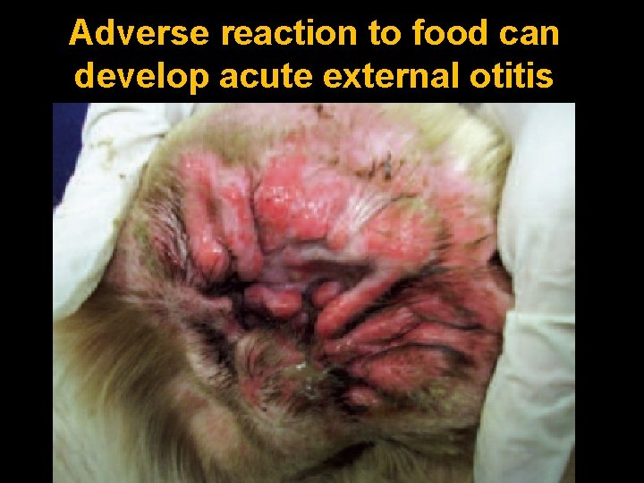 Adverse reaction to food can develop acute external otitis 