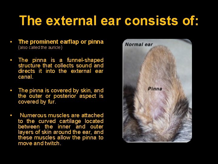 The external ear consists of: • The prominent earflap or pinna • The pinna