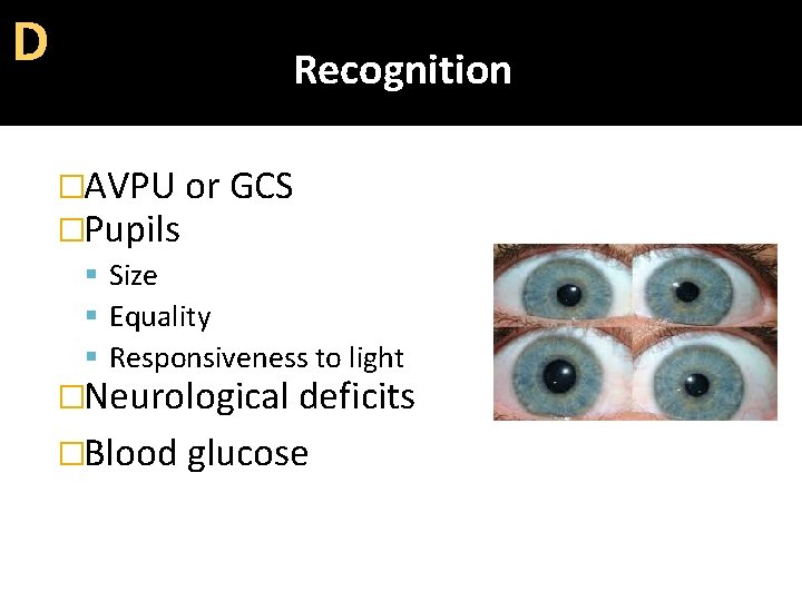 D Recognition �AVPU or GCS �Pupils Size Equality Responsiveness to light �Neurological deficits �Blood
