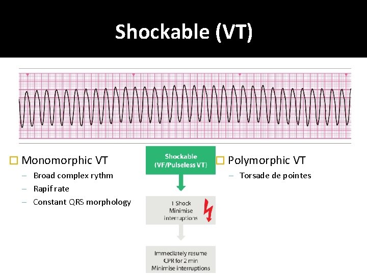 Shockable (VT) � Monomorphic VT – Broad complex rythm – Rapif rate – Constant