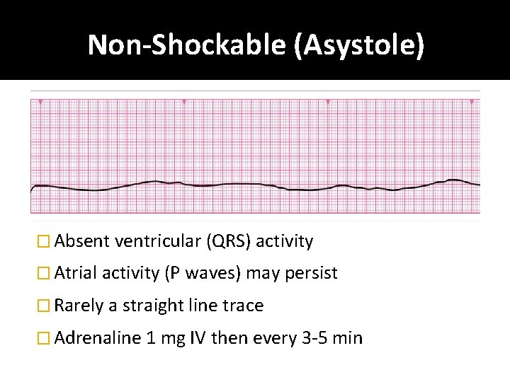 Non-Shockable (Asystole) � Absent ventricular (QRS) activity � Atrial activity (P waves) may persist
