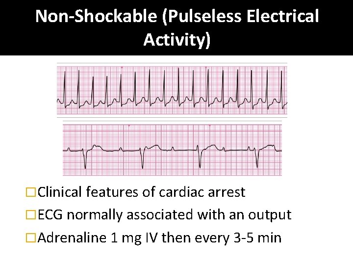 Non-Shockable (Pulseless Electrical Activity) �Clinical features of cardiac arrest �ECG normally associated with an