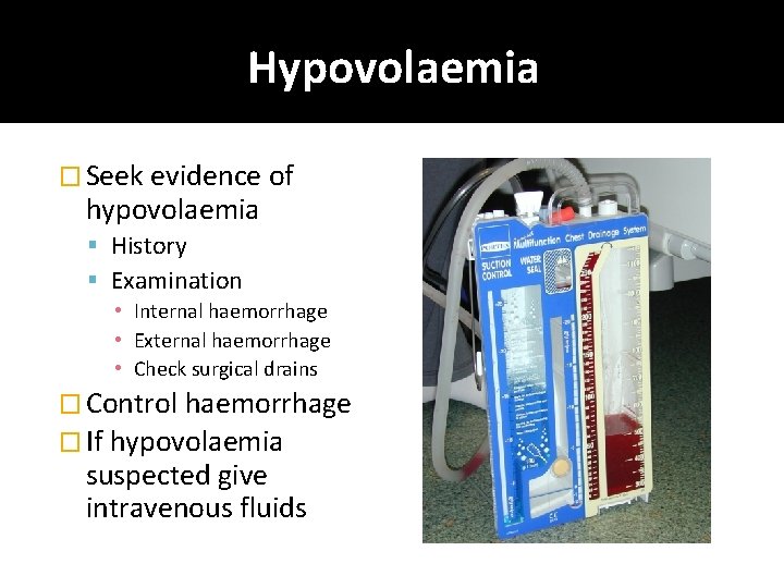 Hypovolaemia � Seek evidence of hypovolaemia History Examination • Internal haemorrhage • External haemorrhage