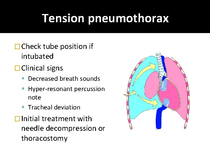 Tension pneumothorax � Check tube position if intubated � Clinical signs Decreased breath sounds