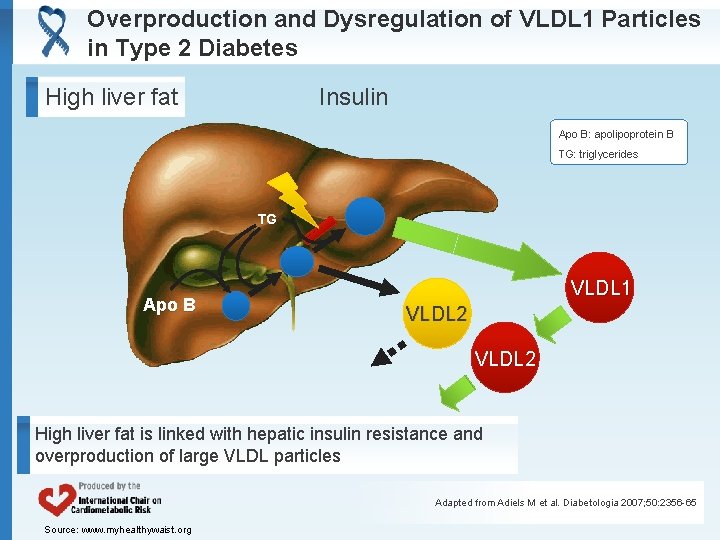 Overproduction and Dysregulation of VLDL 1 Particles in Type 2 Diabetes Insulin High liver