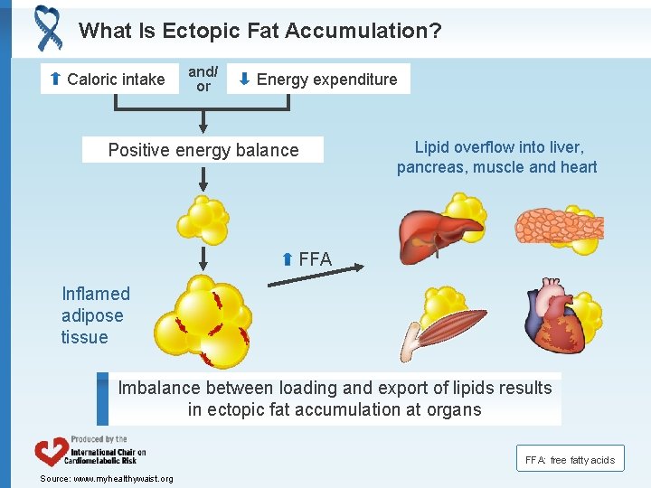 What Is Ectopic Fat Accumulation? Caloric intake and/ or Energy expenditure Positive energy balance