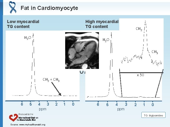 Fat in Cardiomyocyte Low myocardial TG content High myocardial TG content H 2 O