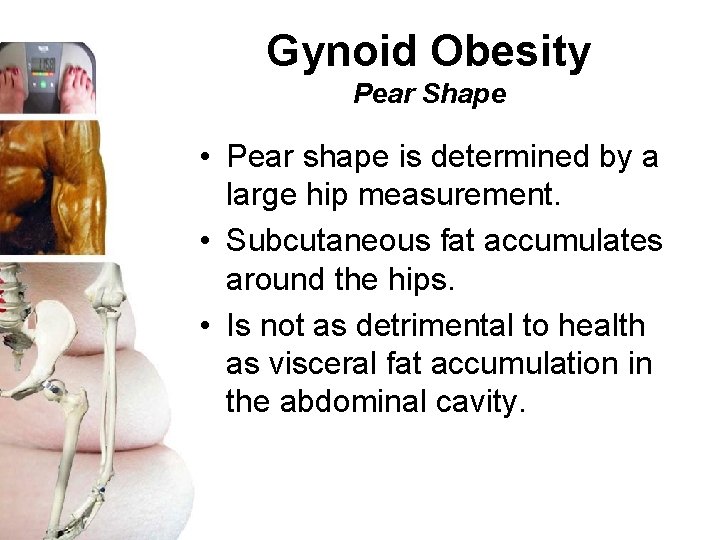 Gynoid Obesity Pear Shape • Pear shape is determined by a large hip measurement.