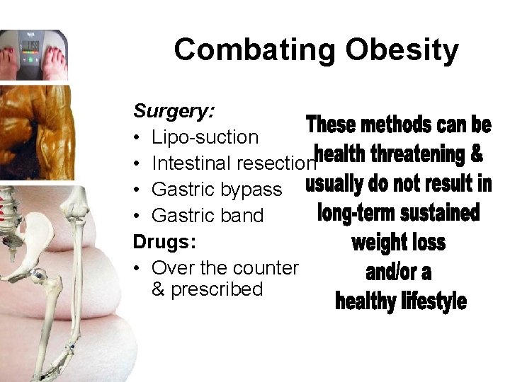 Combating Obesity Surgery: • Lipo-suction • Intestinal resection • Gastric bypass • Gastric band