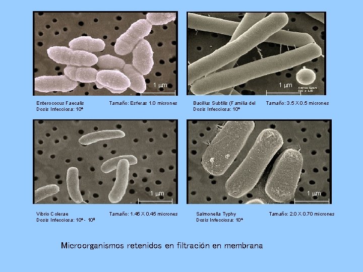 1 m Enterococus Faecalis Dosis Infecciosa: 104 Tamaño: Esferas 1. 0 micrones 1 m