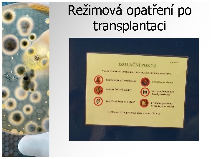 Režimová opatření po transplantaci 