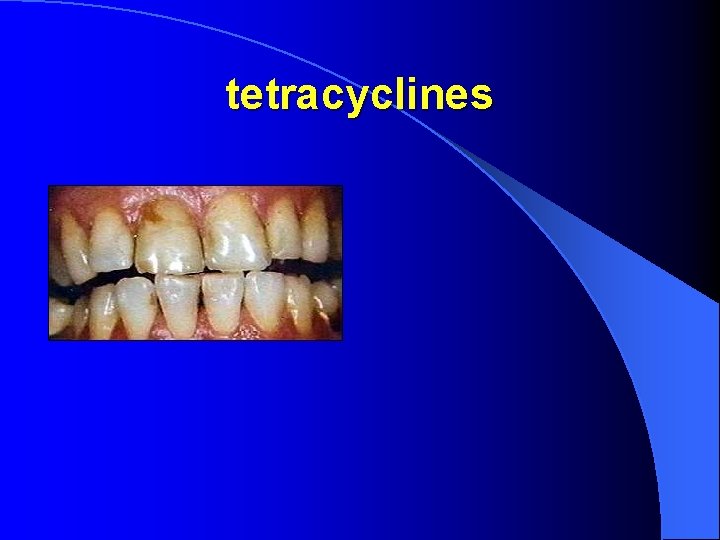 tetracyclines 