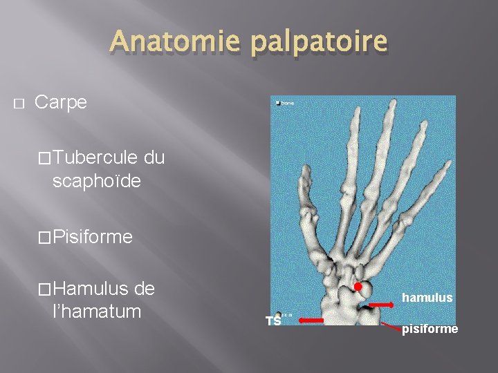 Anatomie palpatoire � Carpe �Tubercule du scaphoïde �Pisiforme �Hamulus de l’hamatum hamulus TS pisiforme