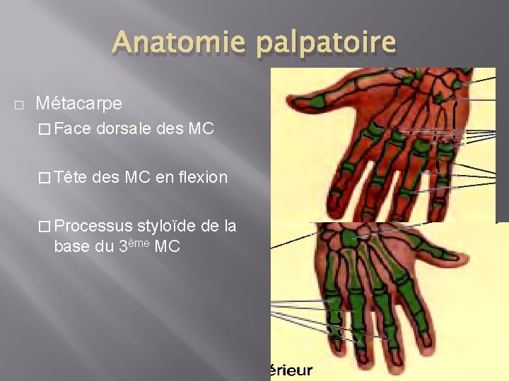 Anatomie palpatoire � Métacarpe � Face dorsale des MC � Tête des MC en