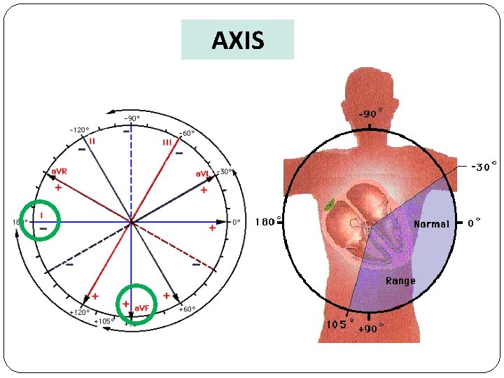 AXIS 