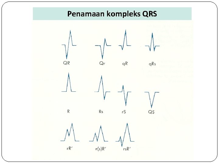 Penamaan kompleks QRS 