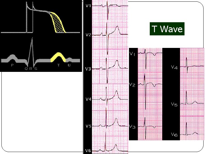 T Wave 