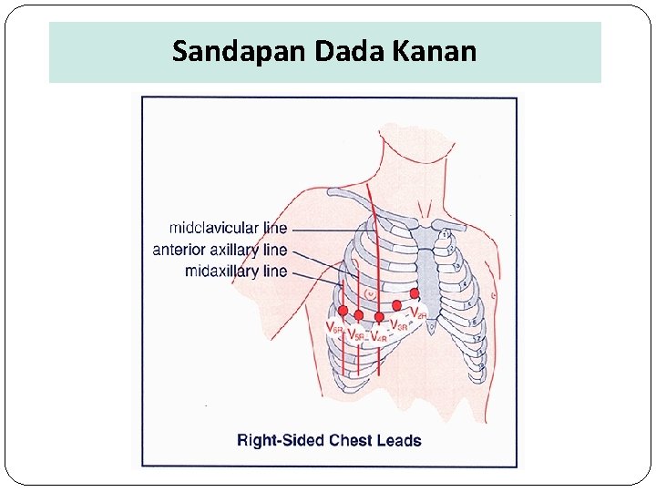 Sandapan Dada Kanan 