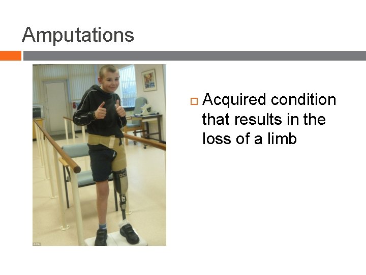 Amputations Acquired condition that results in the loss of a limb 3 