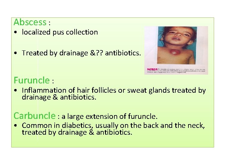 Abscess : • localized pus collection • Treated by drainage &? ? antibiotics. Furuncle