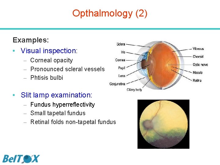 Opthalmology (2) Examples: • Visual inspection: – Corneal opacity – Pronounced scleral vessels –