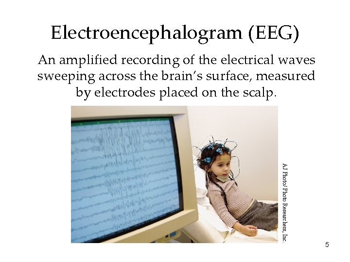 Electroencephalogram (EEG) An amplified recording of the electrical waves sweeping across the brain’s surface,