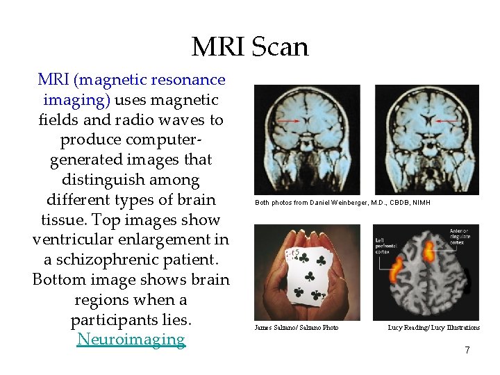MRI Scan MRI (magnetic resonance imaging) uses magnetic fields and radio waves to produce