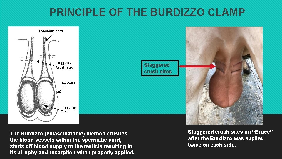 PRINCIPLE OF THE BURDIZZO CLAMP Staggered crush sites The Burdizzo (emasculatome) method crushes the PRINCIPLE OF THE BURDIZZO CLAMP Staggered crush sites The Burdizzo (emasculatome) method crushes the