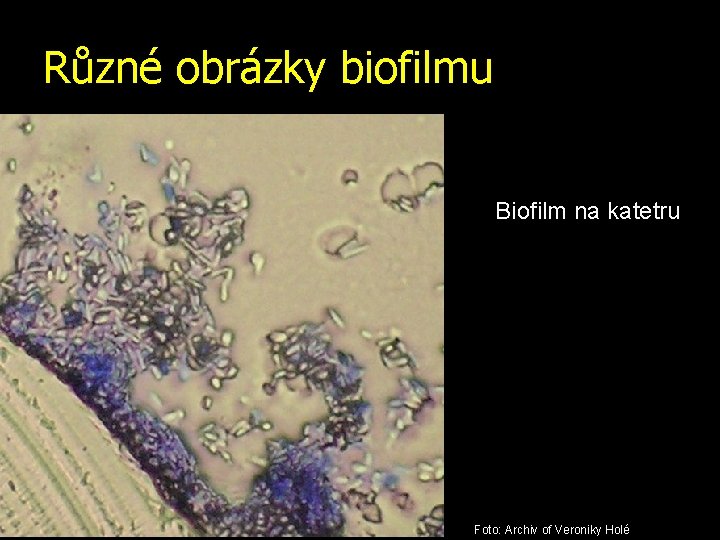 Různé obrázky biofilmu Biofilm na katetru Foto: Archiv of Veroniky Holé 