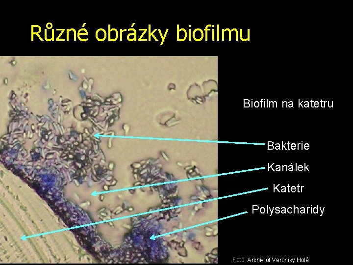 Různé obrázky biofilmu Biofilm na katetru Bakterie Kanálek Katetr Polysacharidy Foto: Archiv of Veroniky