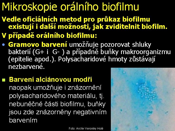 Mikroskopie orálního biofilmu Vedle oficiálních metod pro průkaz biofilmu existují i další možnosti, jak