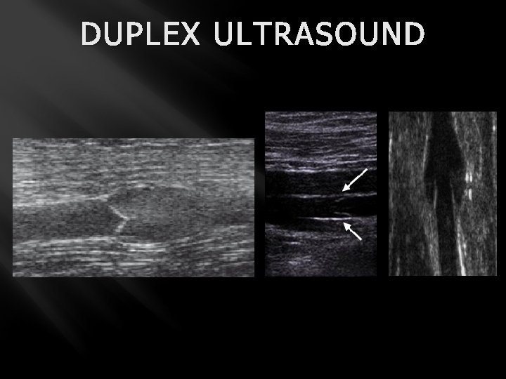 DUPLEX ULTRASOUND 