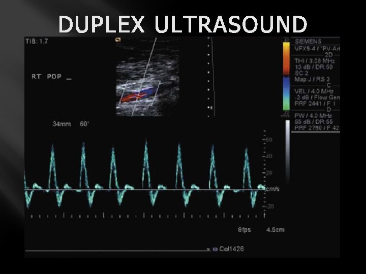 DUPLEX ULTRASOUND 