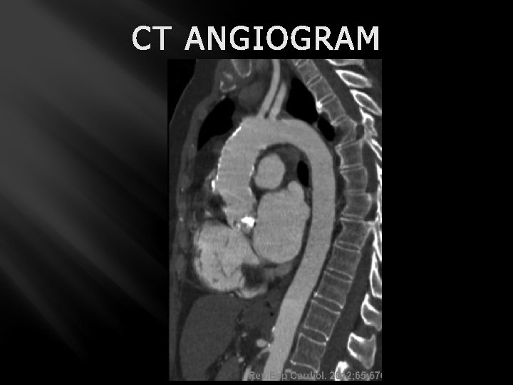 CT ANGIOGRAM 