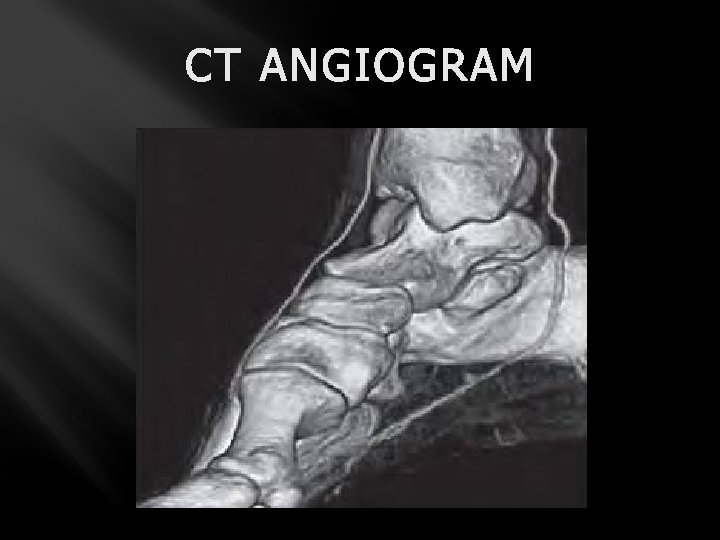 CT ANGIOGRAM 