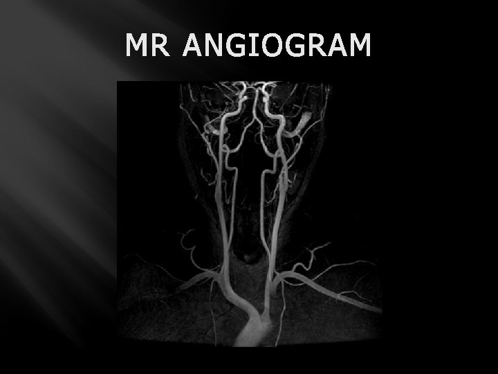 MR ANGIOGRAM 
