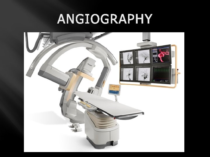 ANGIOGRAPHY 