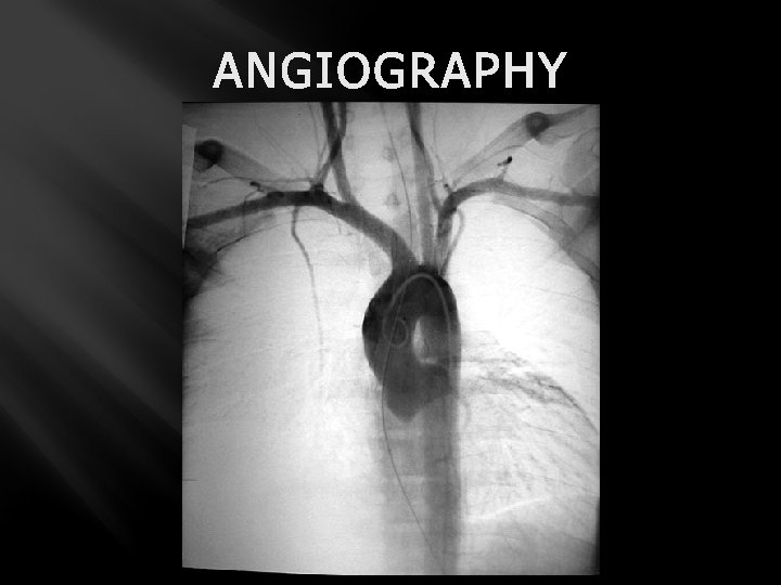 ANGIOGRAPHY 