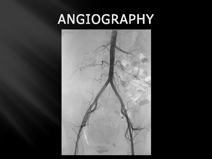 ANGIOGRAPHY 