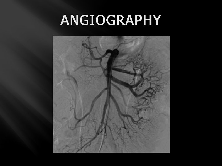 ANGIOGRAPHY 