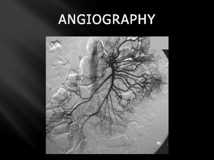 ANGIOGRAPHY 