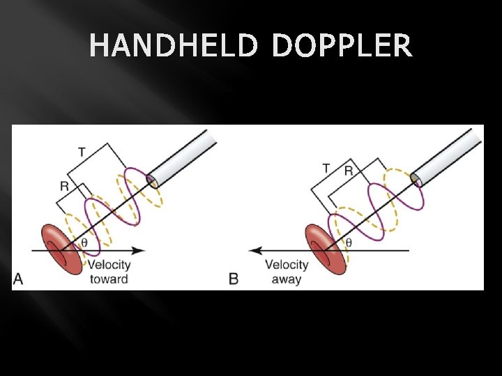 HANDHELD DOPPLER 