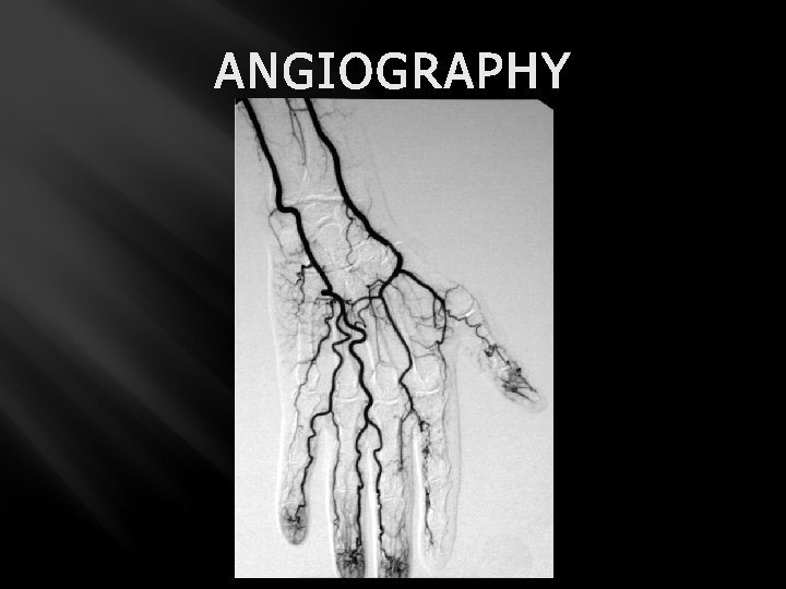 ANGIOGRAPHY 