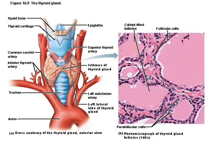 Figure 16. 9 The thyroid gland. Hyoid bone Thyroid cartilage Common carotid artery Inferior
