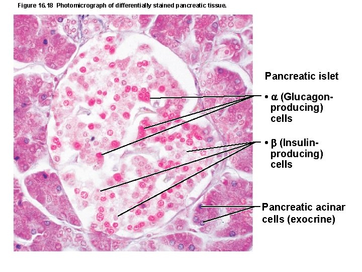 Figure 16. 18 Photomicrograph of differentially stained pancreatic tissue. Pancreatic islet • (Glucagonproducing) cells