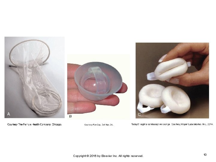 Copyright © 2016 by Elsevier Inc. All rights reserved. 10 